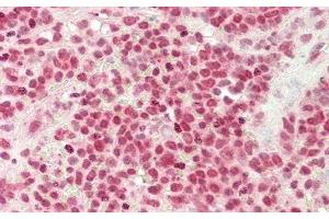 Detection of DNASE1 in Human Spleen Tissue using Monoclonal Antibody to Deoxyribonuclease I (DNASE1) (DNASE1 抗体  (AA 19-259))