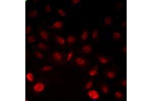 Immunofluorescent analysis of INTS6 staining in Hela cells. (INTS6 抗体)