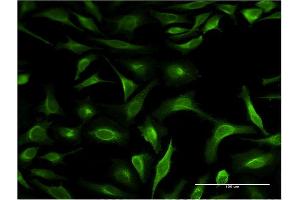 Immunofluorescence of monoclonal antibody to S100P on HeLa cell. (S100P 抗体  (AA 1-69))