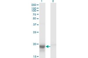 Western Blot analysis of SKP1 expression in transfected 293T cell line by SKP1A monoclonal antibody (M01), clone 1H8. (SKP1 抗体  (AA 53-160))