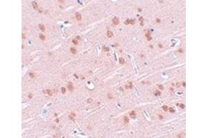 Immunohistochemical staining of rat brain tissue with SYNGR1 polyclonal antibody  at 25 ug/mL dilution. (Synaptogyrin 1 抗体)