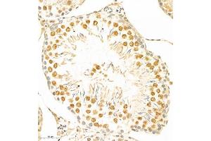 Immunohistochemistry of paraffin embedded rat testis using HRP3 (ABIN7074198) at dilution of 1:1000 (300x lens) (HDGFRP3 抗体)