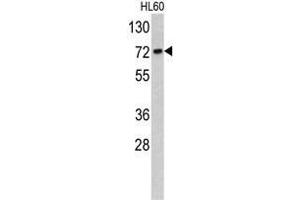 Western blot analysis of TOMM70A antibody (C-term) in HL60 cell line lysates (35ug/lane). (TOM70 抗体  (C-Term))