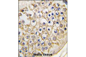 Formalin-fixed and paraffin-embedded human testis tissue reacted with Trpv3 polyclonal antibody  , which was peroxidase-conjugated to the secondary antibody, followed by DAB staining. (TRPV3 抗体  (C-Term))