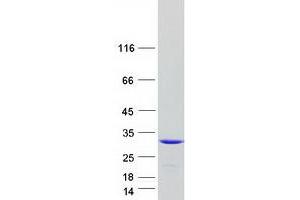 Western Blotting (WB) image for rho GDP Dissociation Inhibitor (GDI) beta (ARHGDIB) protein (Myc-DYKDDDDK Tag) (ABIN2714888)