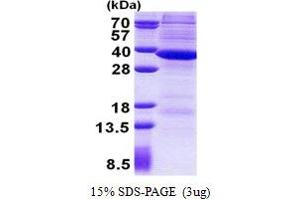 SDS-PAGE (SDS) image for Ribonuclease H2, Subunit A (RNASEH2A) (AA 1-299) protein (His tag) (ABIN5853013)