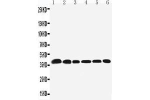 Anti-Nucleophosmin antibody, Western blotting Lane 1: Rat Testis Tissue Lysate Lane 2: Rat Brain Tissue Lysate Lane 3: HELA Cell Lysate Lane 4: U87 Cell Lysate Lane 5: A549 Cell LysateLane6: SMMC Cell Lysate (NPM1 抗体  (N-Term))