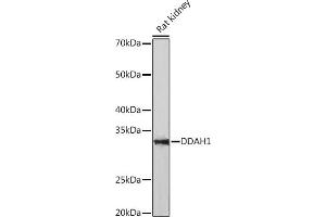 Western blot analysis of extracts of Rat kidney, using DD Rabbit mAb (ABIN7266778) at 1:1000 dilution. (DDAH1 抗体)