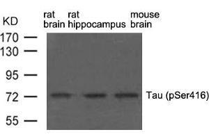 Western blot analysis of extract from rat brain, rat hippocampus and mouse brain using Tau(phospho-Ser416) Antibody. (MAPT 抗体  (pSer416))