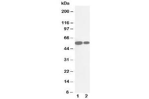 Western blot testing of Cytochrome P450 2E1 antibody and Lane 1:  rat liver (CYP2E1 抗体  (N-Term))