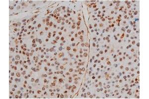 ABIN6267433 at 1/200 staining Human tonsil tissue sections by IHC-P. (Filamin A 抗体  (pSer2152))