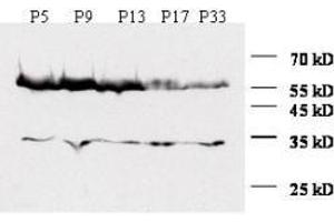 Anti-Zic1 Antibody - Western Blot A similar time course experiment is shown using mouse cerebellum extracts at various time points. (ZIC1 抗体  (N-Term))
