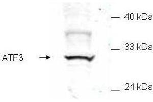 Western blot of mammalian whole cell extract transfected with HA epitope tagged human ATF3. (ATF3 抗体  (Internal Region))