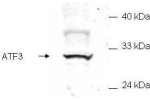 Western blot of mammalian whole cell extract transfected with HA epitope tagged human ATF3. (ATF3 抗体  (AA 113-130))