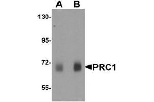 Western blot analysis of PRC1 in human skeletal muscle tissue lysate with Prc1 antibody at (A) 0. (PRC1 抗体  (Middle Region))