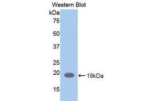 Detection of Recombinant LIFR, Human using Polyclonal Antibody to Leukemia Inhibitory Factor Receptor (LIFR) (LIFR 抗体  (AA 692-833))