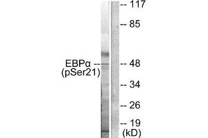 Western blot analysis of extracts from HepG2 cells treated with EGF using C/EBP-α (phospho-Ser21) Antibody. (CEBPA 抗体  (pSer21))