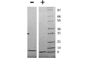 SDS-PAGE of Mouse Monocyte Chemotactic Protein-2 (CCL8) Recombinant Protein SDS-PAGE of Mouse Monocyte Chemotactic Protein-2 (CCL8) Recombinant Protein. (CCL8 蛋白)