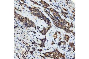 IHC analysis of Aurora A/AURKA using anti-Aurora A/AURKA antibody (ABIN7600751).