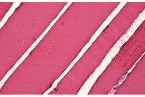 Anti-CKM antibody IHC staining of human skeletal muscle. (CKM 抗体  (AA 10-59))