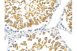 ABIN6257454 and ABIN6275443 at 1/100 staining Rat testis tissue by IHC-P.
