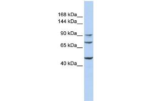 WB Suggested Anti-GALNT5 Antibody Titration:  0. (GALNT5 抗体  (Middle Region))