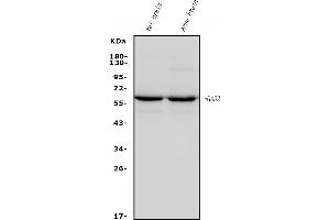 Western blot analysis of GAD65/GAD2 using anti-GAD65/GAD2 antibody (ABIN7603169).