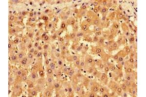 Immunohistochemistry (IHC) image for anti-TROVE Domain Family, Member 2 (TROVE2) (AA 3-535) antibody (ABIN7142715)