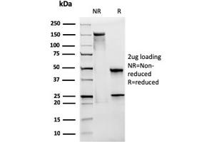 SDS-PAGE Analysis Purified CD28 Mouse Monoclonal Antibody (CB28). (CD28 抗体)