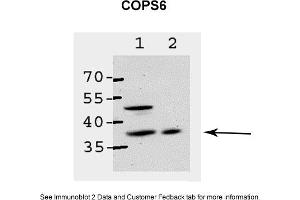 Sample Type: 1. (COPS6 抗体  (Middle Region))