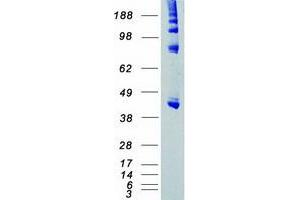 Western Blotting (WB) image for Branched Chain Ketoacid Dehydrogenase Kinase (BCKDK) (Transcript Variant 1) protein (Myc-DYKDDDDK Tag) (ABIN2715189)