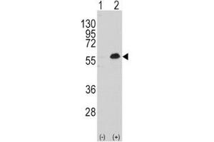 Western blot analysis of MEF2C antibody and 293 cell lysate either nontransfected (Lane 1) or transiently transfected with the MEF2C gene (2). (MEF2C 抗体  (AA 278-307))