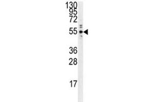 Western Blotting (WB) image for anti-Protein tyrosine Phosphatase, Non-Receptor Type 1 (PTPN1) antibody (ABIN3032393)