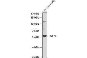 Western blot analysis of extracts of mouse testis, using D antibody (ABIN6127797, ABIN6139413, ABIN6139414 and ABIN6223512) at 1:1000 dilution. (DAZ2 抗体  (AA 1-200))