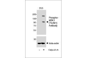 Western blot analysis of lysates from 293 cell line, untreated or treated with Calyculin A, 100nM, 30 min, using Phospho-MSK1 (Thr581) Antibody (upper) or Beta-actin (lower). (MSK1 抗体  (pThr581))