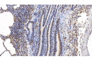 Detection of ERK2 in Porcine Lung Tissue using Monoclonal Antibody to Extracellular Signal Regulated Kinase 2 (ERK2) (ERK2 抗体  (AA 25-360))