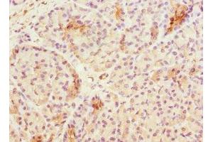 Immunohistochemistry of paraffin-embedded human pancreatic tissue using ABIN7171839 at dilution of 1:100 (ASPSCR1 抗体  (AA 284-553))
