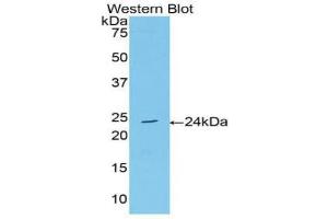 Detection of Recombinant AchE, Human using Polyclonal Antibody to Acetylcholinesterase (ACHE) (Acetylcholinesterase 抗体  (AA 377-574))
