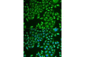 Immunofluorescence analysis of U2OS cells using PNLIP antibody . (PNLIP 抗体  (AA 166-465))