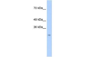 Chymotrypsin-Like antibody used at 0. (Chymotrypsin 抗体  (N-Term))