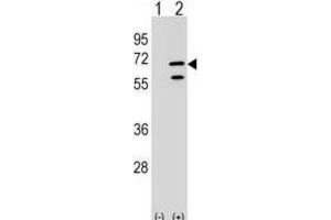 Western Blotting (WB) image for anti-Polymerase (RNA) III (DNA Directed) Polypeptide C (62kD) (POLR3C) antibody (ABIN2999296)