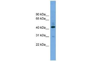 B4GALT2 antibody used at 1 ug/ml to detect target protein. (B4GALT2 抗体  (Middle Region))