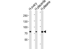Western blot analysis of lysates from human ovary, human placenta, human plasma tissue lysate (from left to right), using ITGB8 Antibody (Center) (ABIN6244113 and ABIN6577824). (ITGB8 抗体  (AA 197-231))