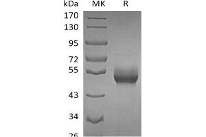 Western Blotting (WB) image for UDP-Gal:betaGlcNAc beta 1,4 Galactosyltransferase, Polypeptide 1 (B4GALT1) protein (His tag) (ABIN7319810) (B4GALT1 Protein (His tag))