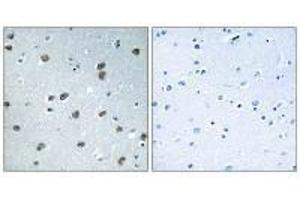Immunohistochemistry analysis of paraffin-embedded human brain tissue using KLHL29 antibody. (KLHL29 抗体)