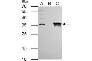 IP Image TFIIE beta antibody immunoprecipitates TFIIE beta protein in IP experiments.