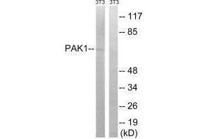 Western blot analysis of extracts from 3T3 cells, treated with UV (15 mins), using PAK1 (Ab-204) antibody. (PAK1 抗体  (Ser204))