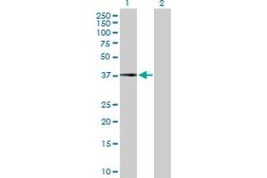 Western Blot analysis of CFHR1 expression in transfected 293T cell line by CFHR1 MaxPab polyclonal antibody. (CFHR1 抗体  (AA 1-330))
