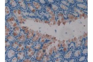 DAB staining on IHC-P; Samples: Mouse Intestine Tissue (GLMN 抗体  (AA 294-549))