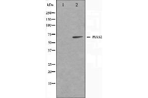 Western blot analysis on COS7 cell lysate using PIAS2 Antibody,The lane on the left is treated with the antigen-specific peptide. (PIAS2 抗体)